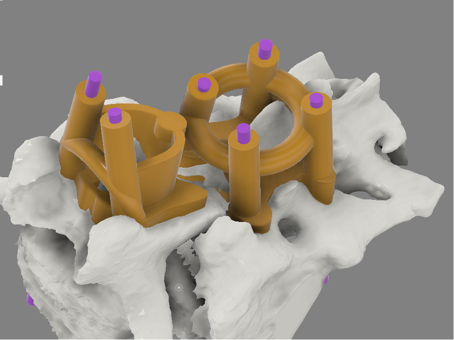 Spinal drill guide 3D model